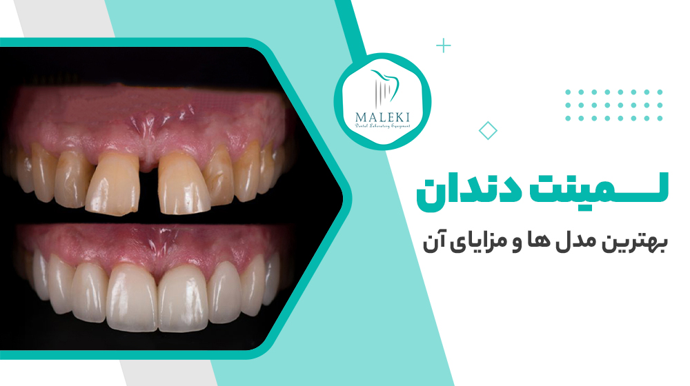 توضیحات عکس
