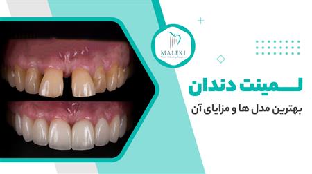 توضیحات عکس