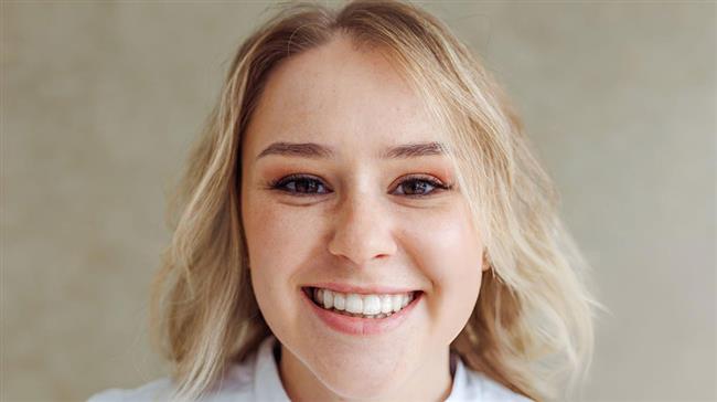 لمینت کامپوزیتی دندان