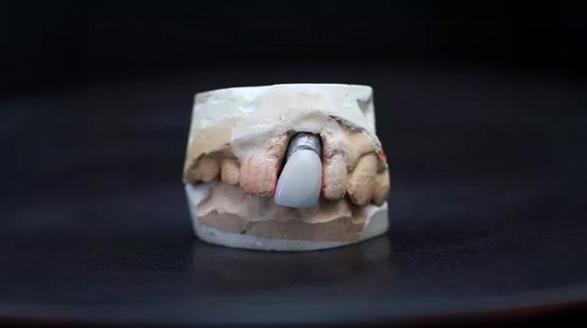 دندان الویس پرسلی