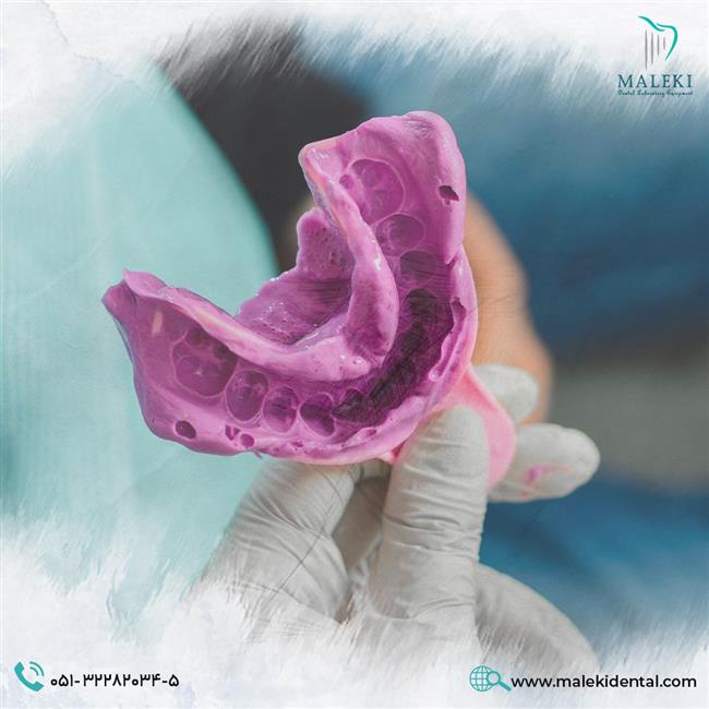 نحوه قالب‌گیری دندان با آلژینات