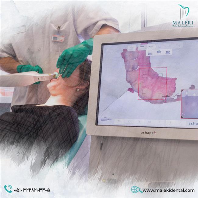 قالب‌گیری دیجیتال دندان