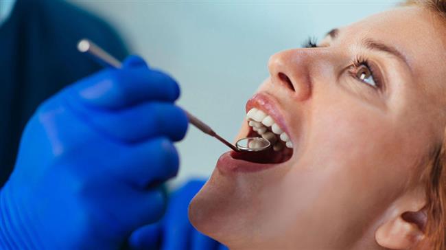 معایب روکش دندان