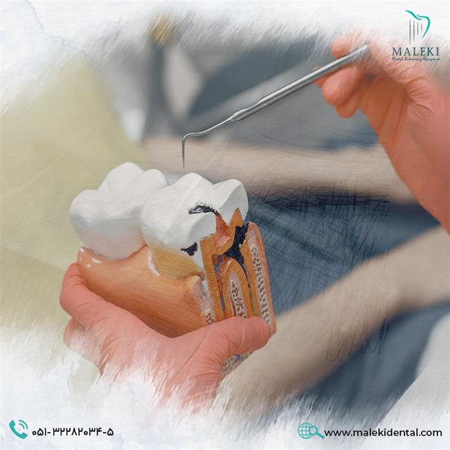 انواع کامپوزیت دندان