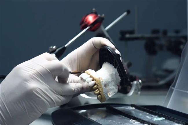 تجهیزات دندانسازی پیشرفته