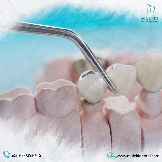 پروتز دندانی ثابت