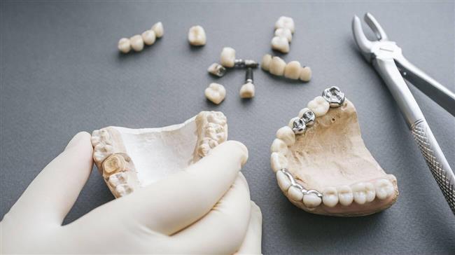 مزایای استفاده از پروتز فلکسی برای دندانپزشکان