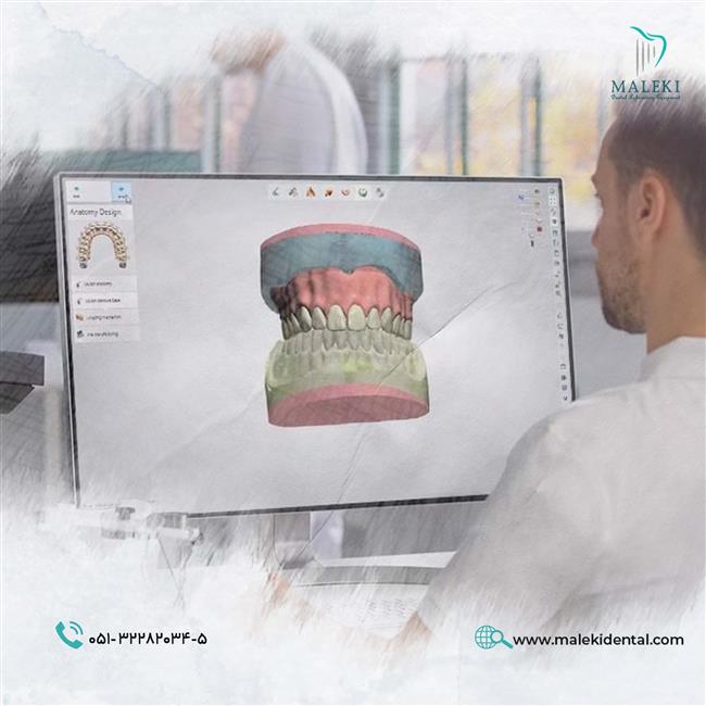 طراحی دیجیتال دندان