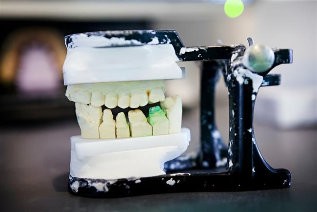 لبخند زیبا و جذاب با جادوی بریج دندان