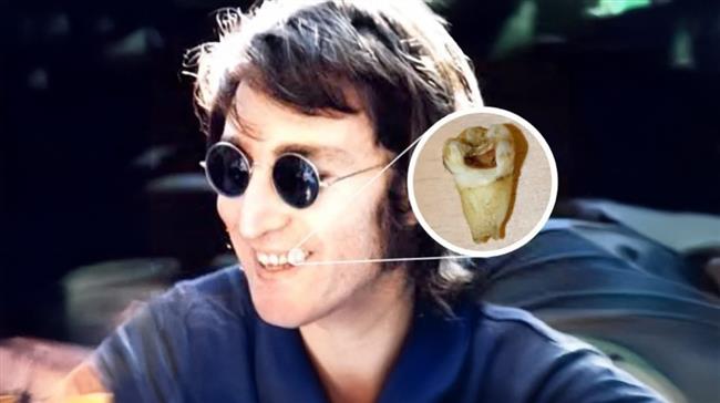 دندان جان لنون به ارزش ۳۱,۰۰۰ دلار