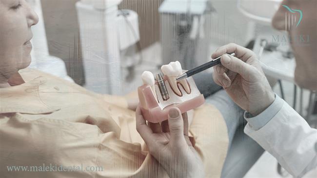 نکات مهم هنگام استفاده از جینجیوال ماسک هنریش