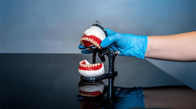 پروتز متحرک