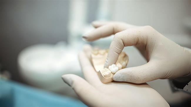 ظاهر غیرواقعی دندان‌مصنوعی