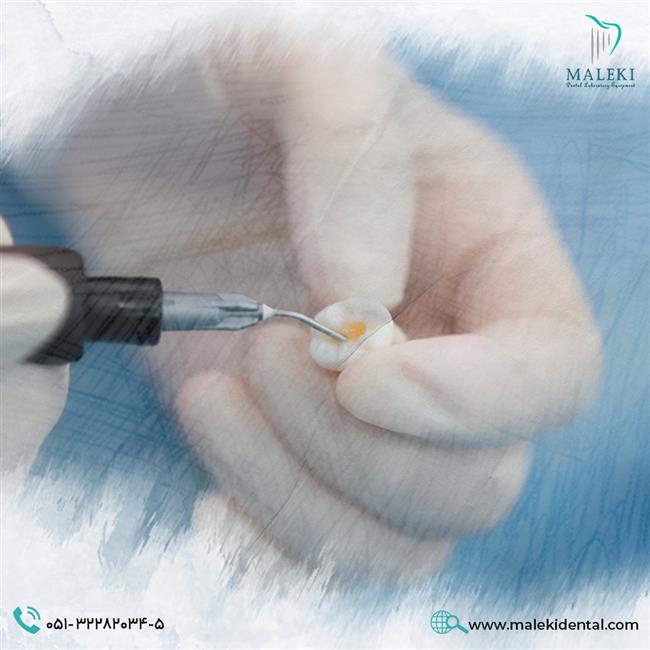 مزایا و معایب کامپوزیت دندان: