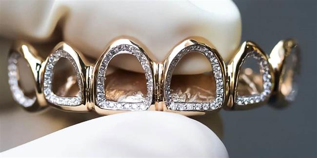 گرانترین دندان های مصنوعی