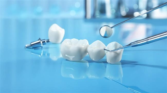 پروتز دندانی ثابت