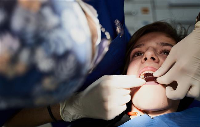 معایب استفاده از بریج‌های دندانی