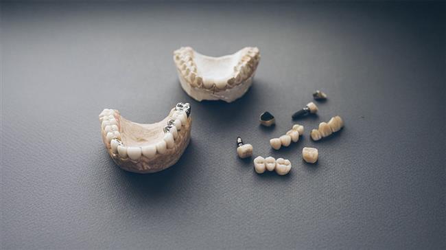 تفاوت پروتز متحرک و ثابت